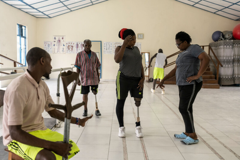 Four people with prosthetic legs are in a rehabilitation room. One woman, guided by an instructor, is learning to walk with her prosthesis while others watch or sit nearby. Rehabilitation equipment and posters are visible in the background.