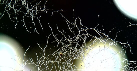 Thin, branching white filaments spread across a dark background, resembling fungal hyphae or root structures, with a few bright, out-of-focus circular spots in the corners.